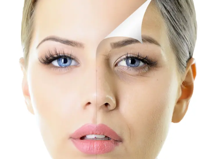 Rejuvenecimiento facial con IPL