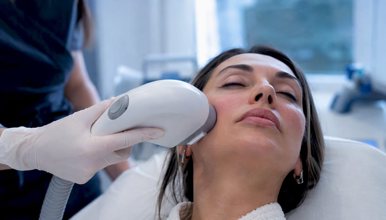 IPL para la rosácea: qué mejora y qué esperar realmente