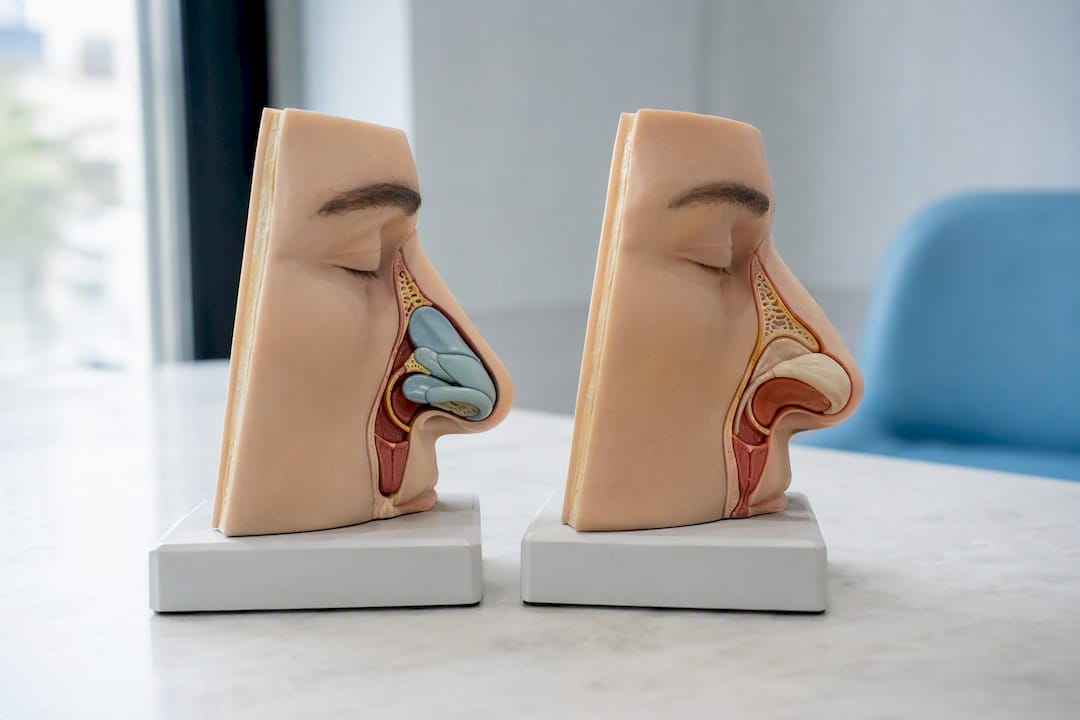 Diferencias entre la rinoplastia quirúrgica y la rinomodelación con rellenos