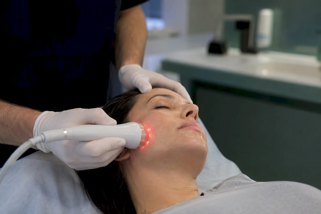 Terapia de radiofrecuencia en la piel facial, primer plano