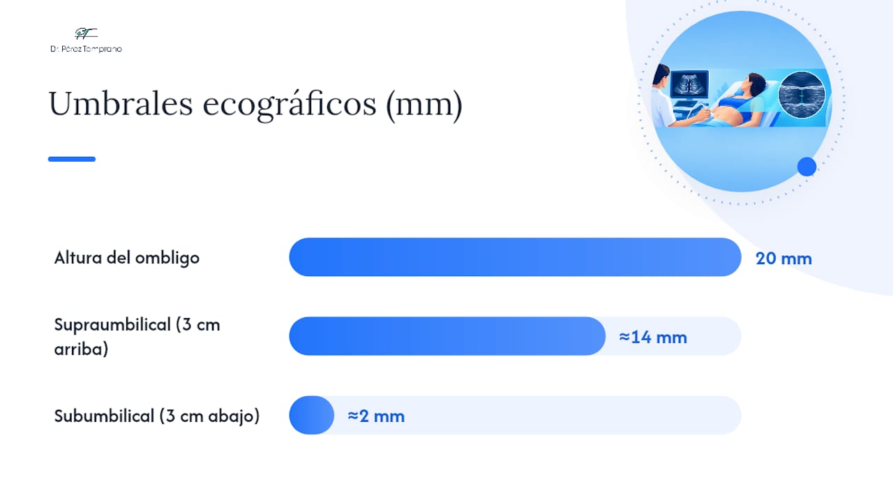 Ecografía o palpación: cómo se mide realmente la diástasis — overview diagram