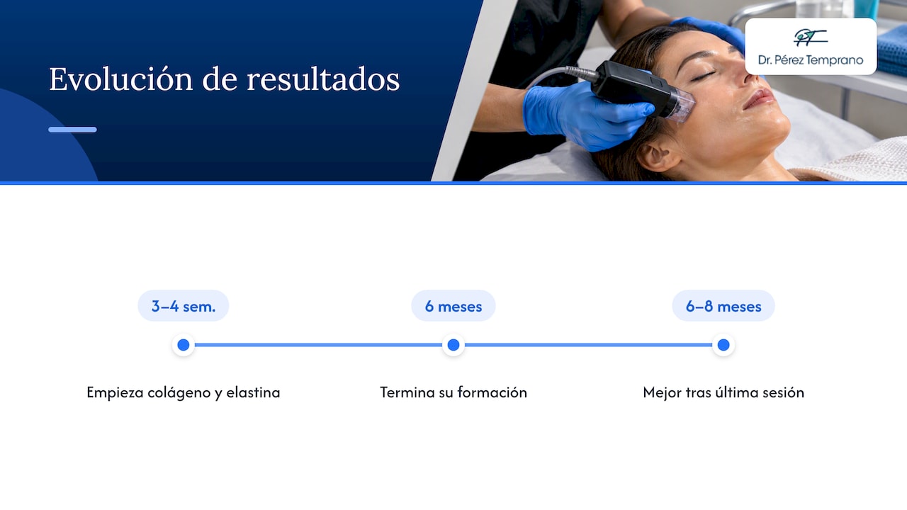 Línea temporal de resultados tras Morpheus8