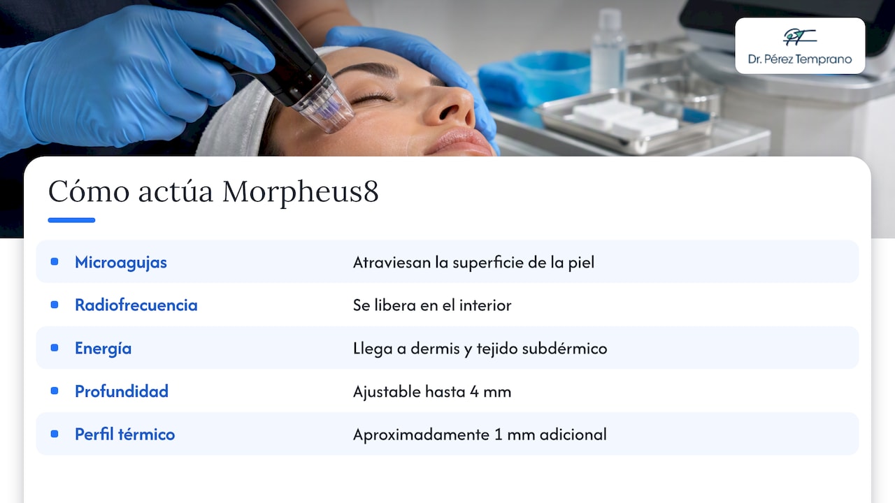 ¿Cómo funciona Morpheus8 con microagujas y radiofrecuencia? — overview diagram