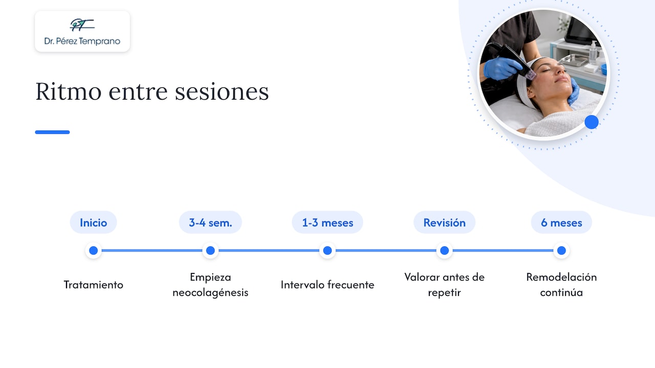 Línea temporal de remodelación y sesiones Morpheus8