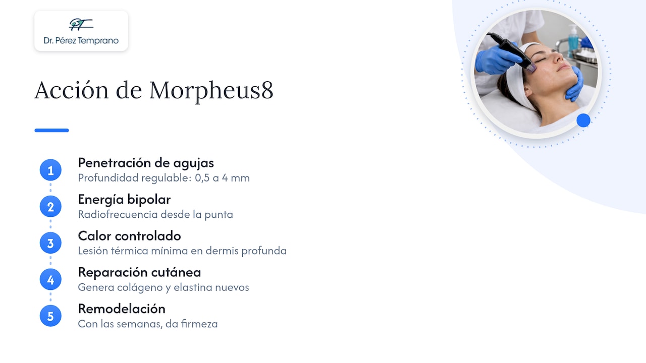 Qué es Morpheus8 y cómo actúa sobre la piel — overview diagram