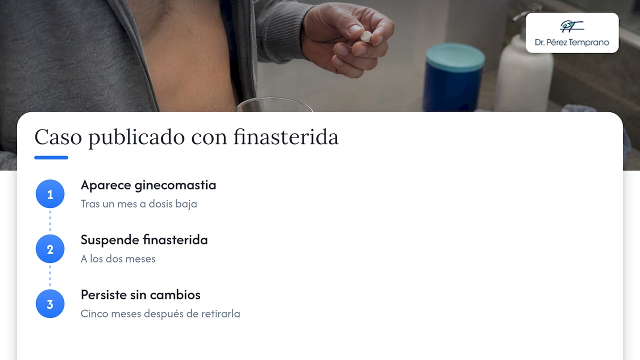 Ginecomastia por finasterida — overview diagram