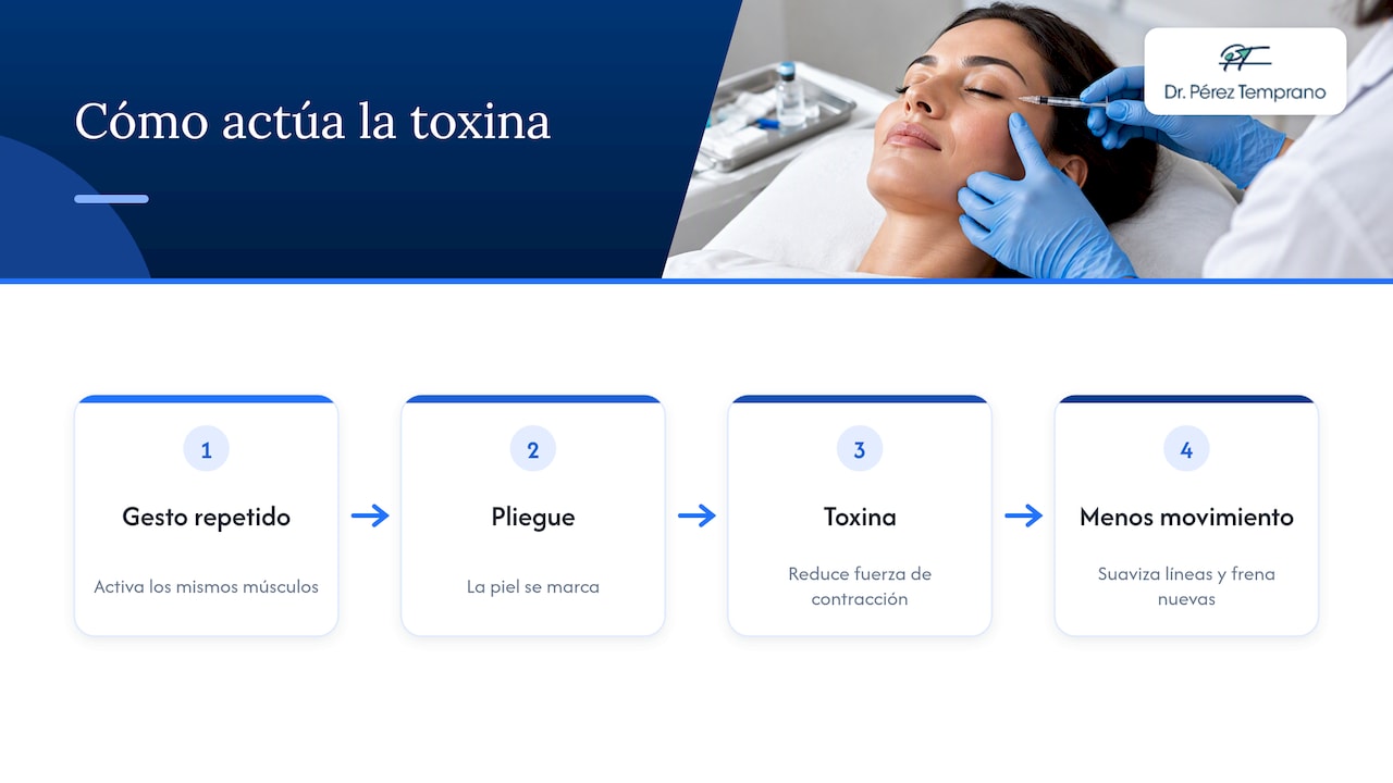 Cómo actúa sobre las arrugas de expresión — overview diagram
